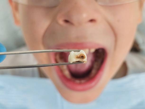 Best Emergency Dentist for Kids  in Boulder, MT